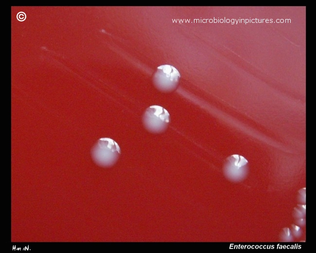 Enterococcus faecalis colonies on blood agar close-up
